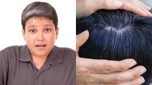 Hair को लेकर हैं परेशान, तो आँवले से करिए अपनी समस्या का समाधान...