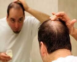 Hair को लेकर हैं परेशान, तो आँवले से करिए अपनी समस्या का समाधान...