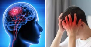 Brain में सूजन के पीछे हो सकती हैं ये 5 घातक बीमारियां,