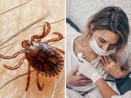 Congo Fever: कांगो फीवर क्या है? जानें इस बीमारी के लक्षण,