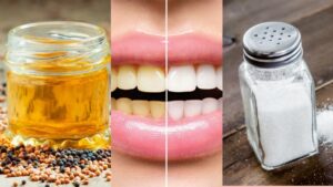 Teeth का पीलापन हटाने के लिए आजमाएं ये 5 घरेलू उपाय, मोतियों जैसे चमकेंगे दांत