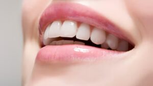 Teeth का पीलापन हटाने के लिए आजमाएं ये 5 घरेलू उपाय, मोतियों जैसे चमकेंगे दांत